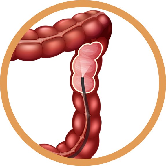 Liver Diseases